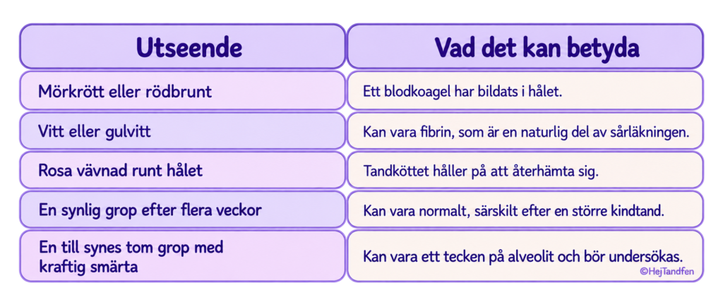 Hur ska hålet se ut efter tandutdragning? Illustrerad tabell över olika färger och utseenden under sårläkningen, från blodkoagel och fibrin till tecken på alveolit.
